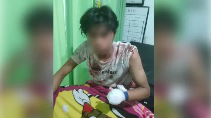 Seorang Remaja di Kendari Dikeroyok OTK hingga Tangannya Putus