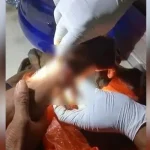 Seorang Pemuda di Desa Lindo Diparangi OTK Karena Tidak Terima Ditegur Seorang Pemuda di Desa Lindo Diparangi OTK Karena Tidak Terima Ditegur