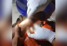 Seorang Pemuda di Desa Lindo Diparangi OTK Karena Tidak Terima Ditegur Seorang Pemuda di Desa Lindo Diparangi OTK Karena Tidak Terima Ditegur