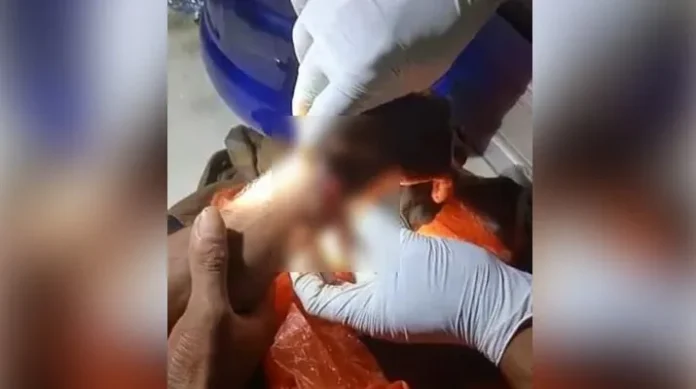 Seorang Pemuda di Desa Lindo Diparangi OTK Karena Tidak Terima Ditegur