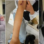 Kronologi Oknum Polisi di Konawe Utara Diduga Aniaya Pacarnya Hingga Babak Belur Kronologi Oknum Polisi di Konawe Utara Diduga Aniaya Pacarnya Hingga Babak Belur