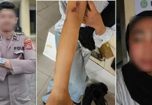 Kronologi Oknum Polisi di Konawe Utara Diduga Aniaya Pacarnya Hingga Babak Belur Kronologi Oknum Polisi di Konawe Utara Diduga Aniaya Pacarnya Hingga Babak Belur